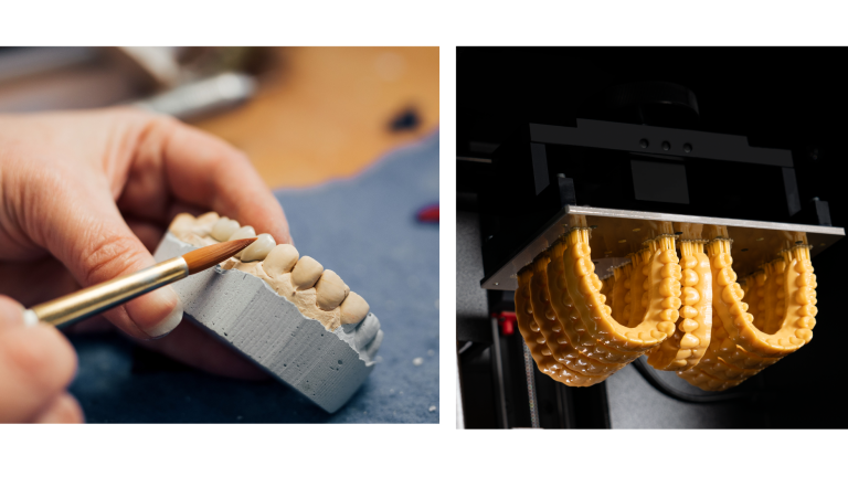 Vergleich Gips vs 3D Druck