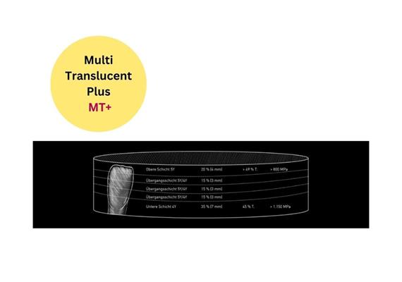 Tizian Blank MT + A3.5 98 x 16 mm